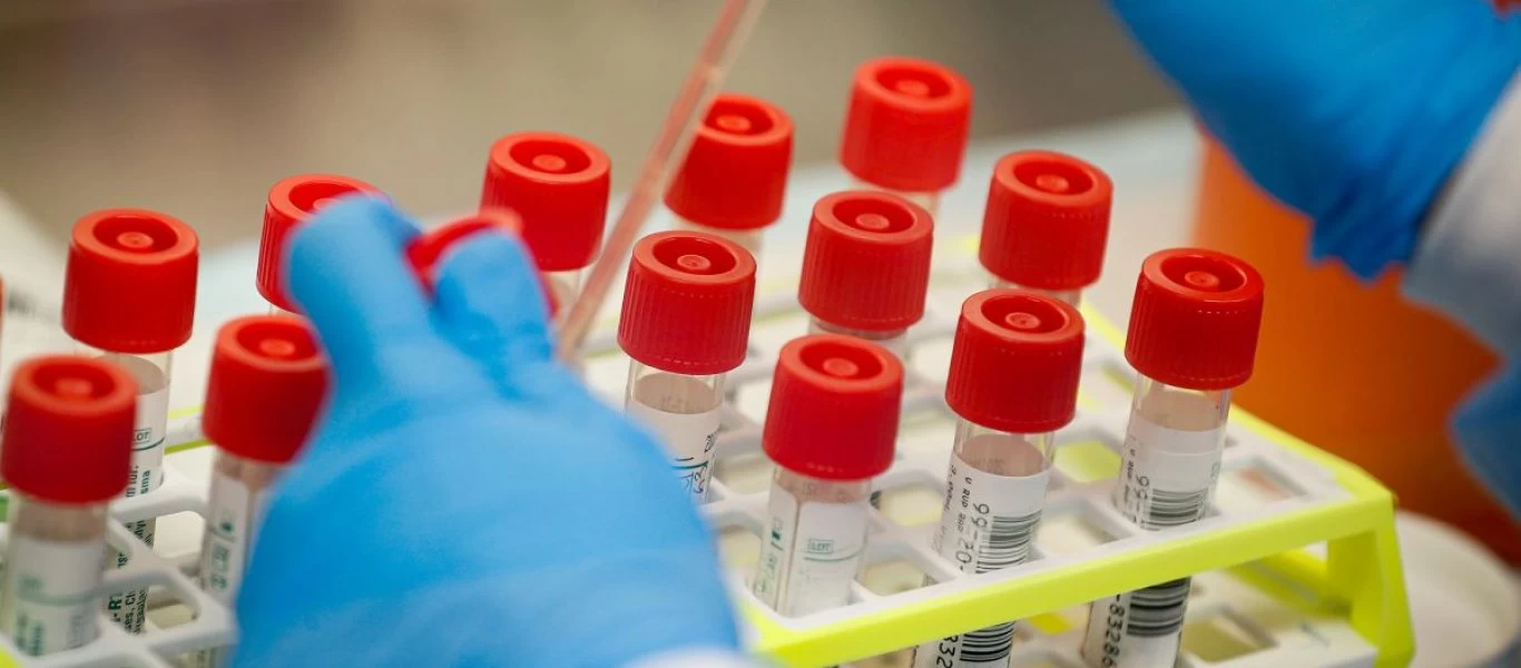 Φθιώτιδα: Τι έδειξαν τα αποτελέσματα των τεστ για τον κορωνοϊό;